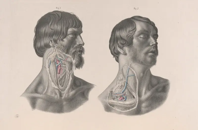 Surgical anatomy Pl.07 av Joseph Maclise