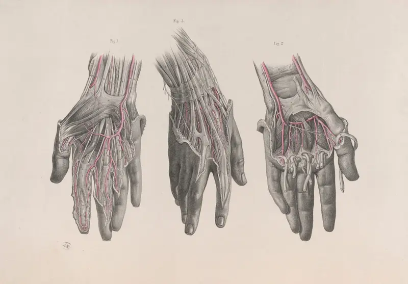 Surgical anatomy Pl.13 av Joseph Maclise