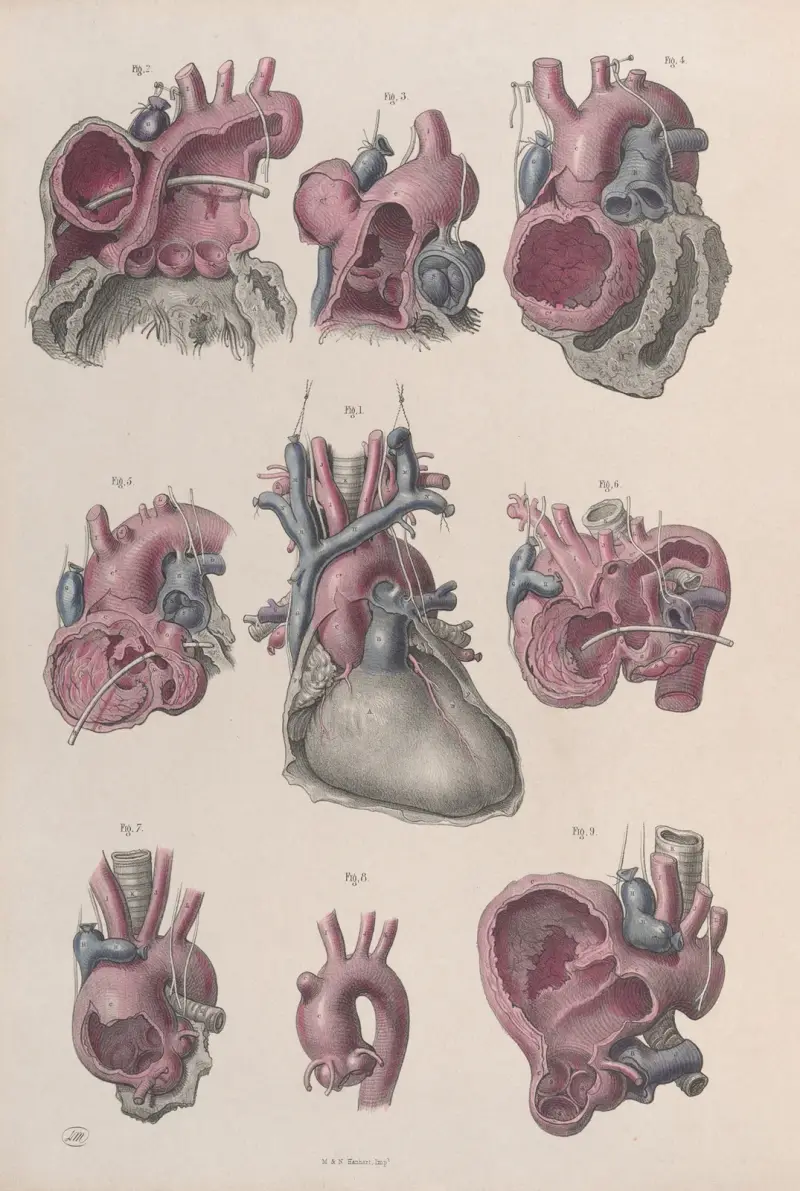 Surgical anatomy Pl.14 av Joseph Maclise