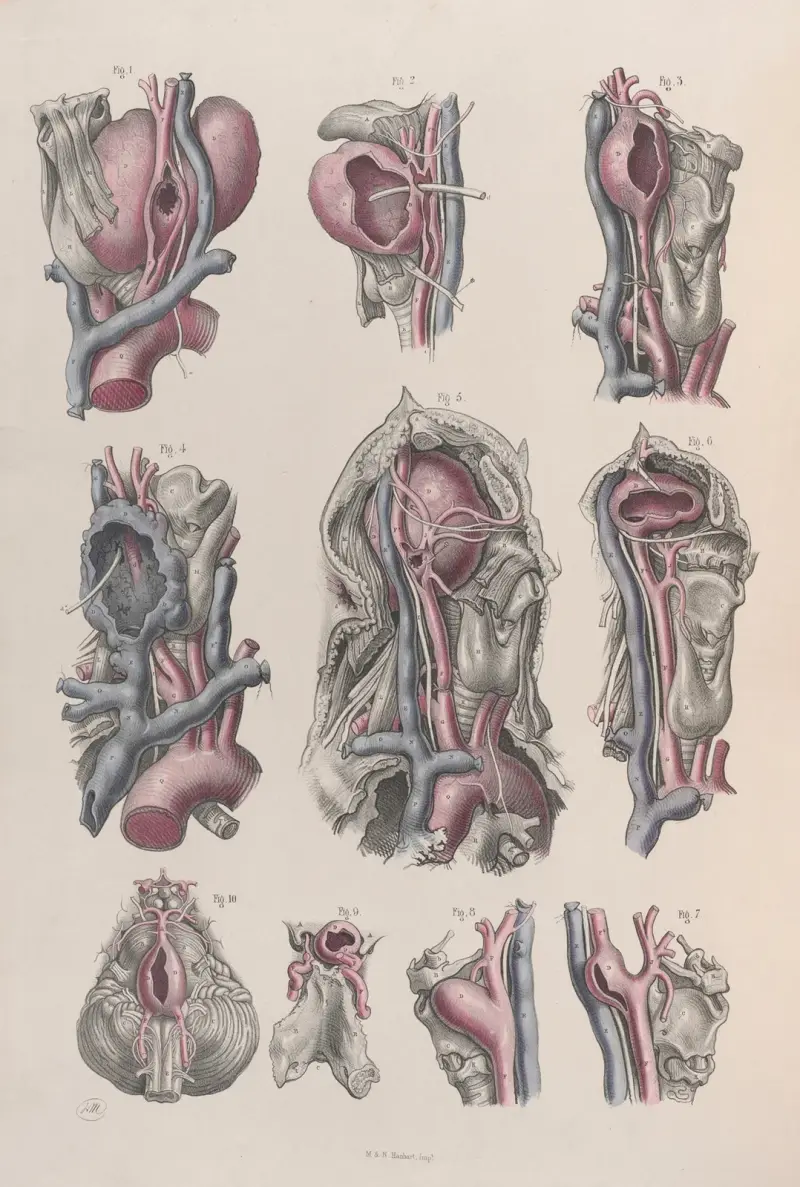 Surgical anatomy Pl.17 av Joseph Maclise