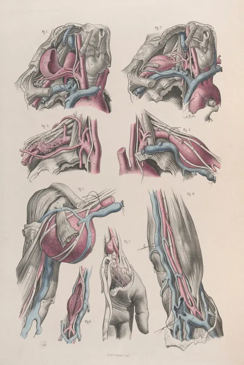 Surgical anatomy Pl.18 av Joseph Maclise