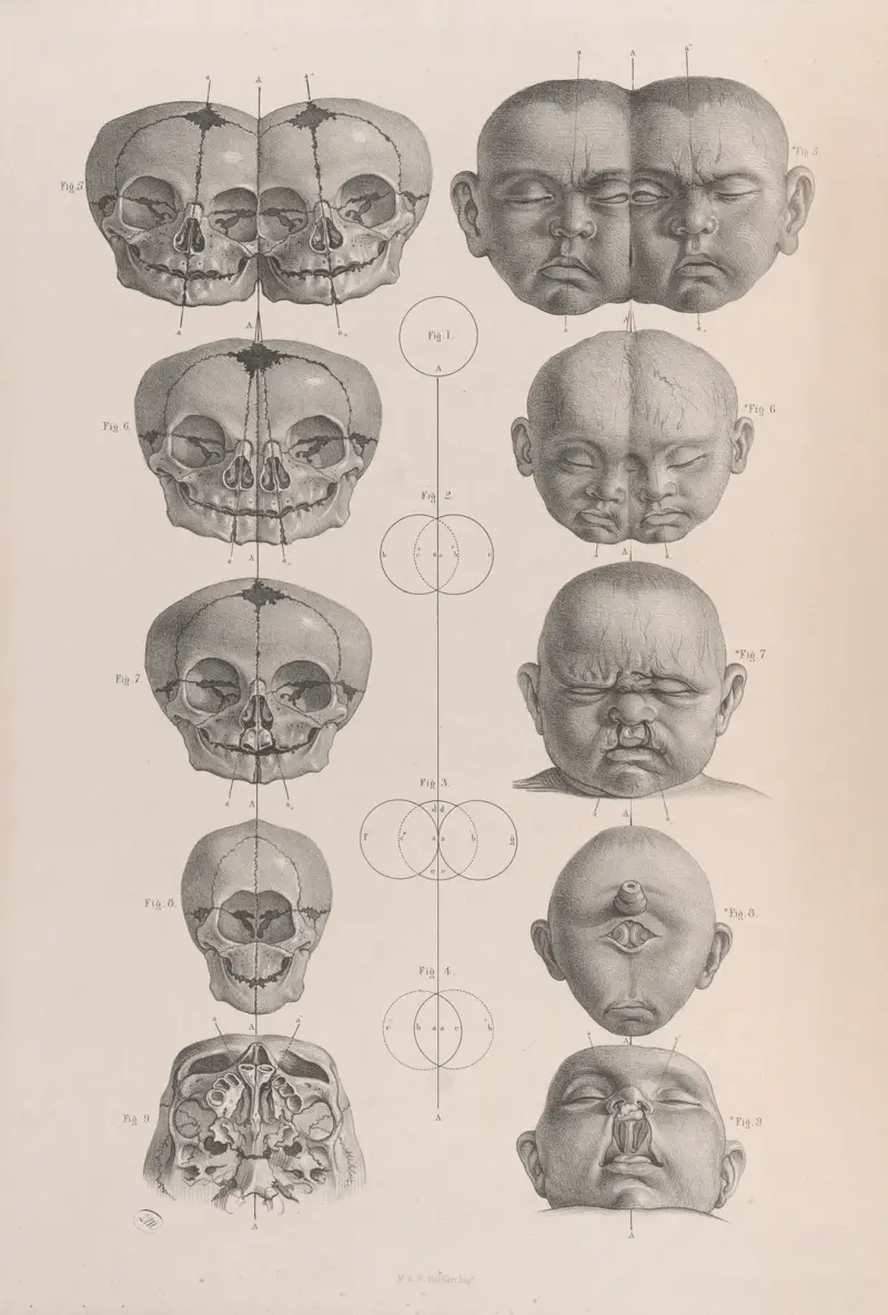 Surgical anatomy Pl.19 av Joseph Maclise