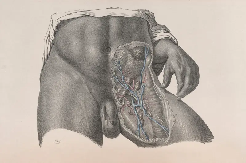 Surgical anatomy Pl.26 av Joseph Maclise
