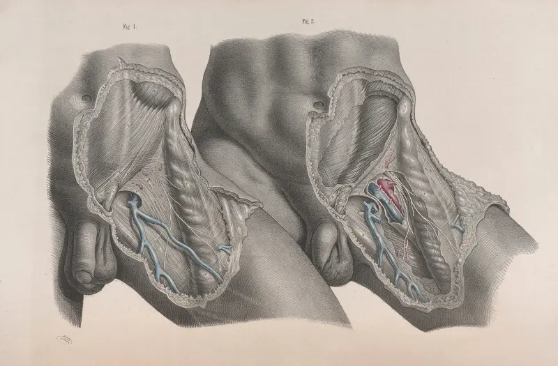 Surgical anatomy Pl.27 av Joseph Maclise