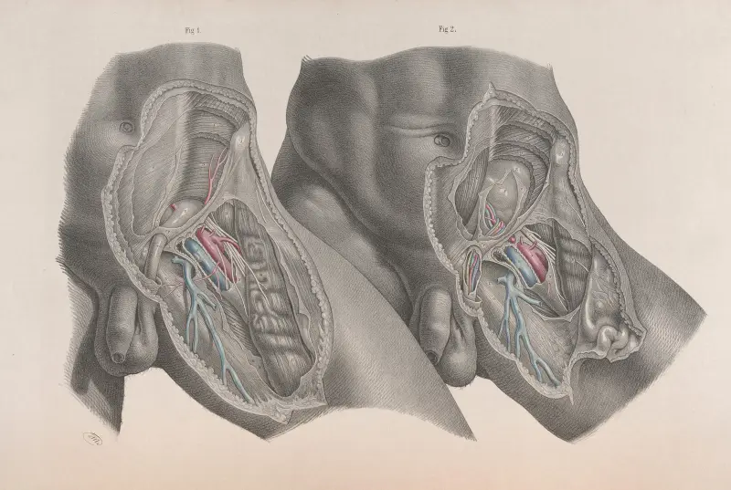 Surgical anatomy Pl.28 av Joseph Maclise