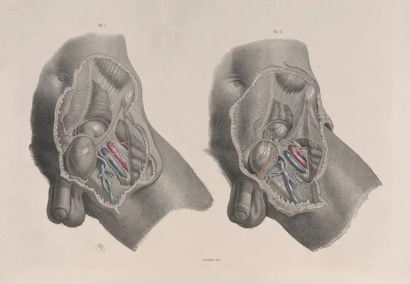 Surgical anatomy Pl.30 av Joseph Maclise
