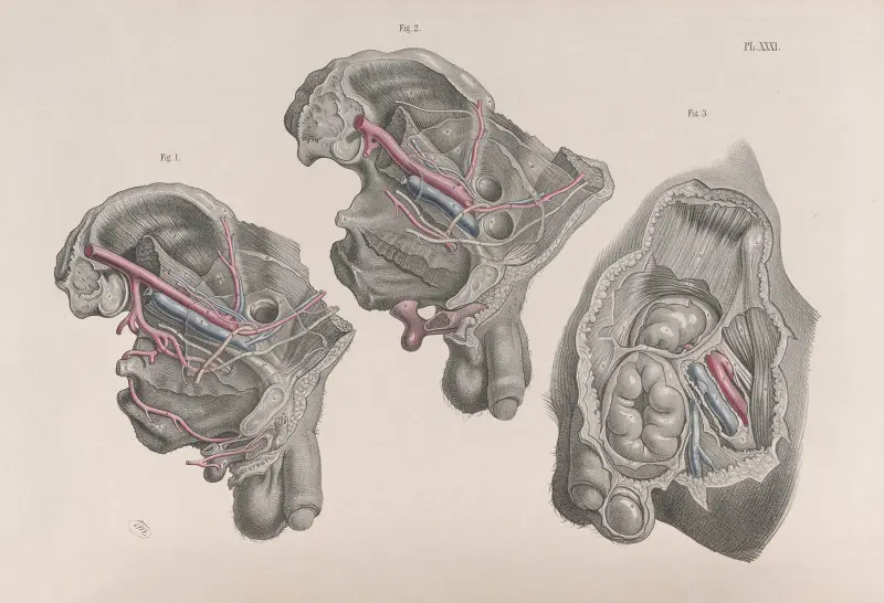 Surgical anatomy Pl.31 av Joseph Maclise