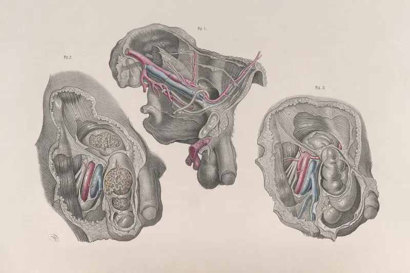 Surgical anatomy Pl.32 av Joseph Maclise