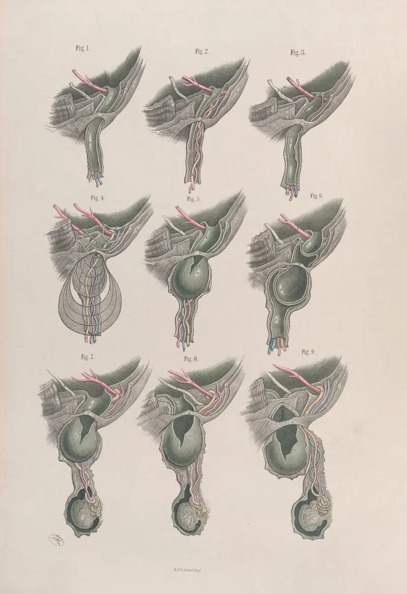 Surgical anatomy Pl.33 av Joseph Maclise