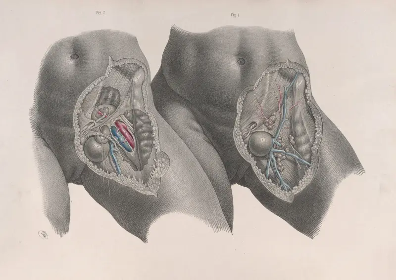 Surgical anatomy Pl.35 av Joseph Maclise