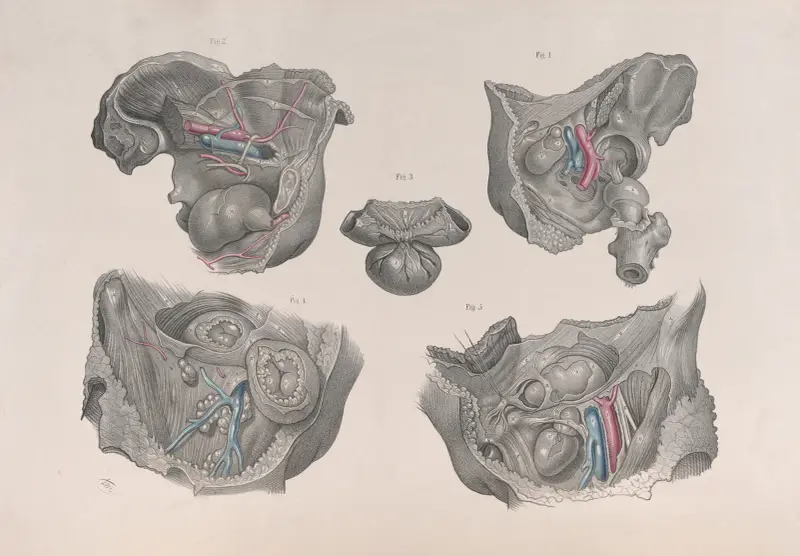 Surgical anatomy Pl.36 av Joseph Maclise