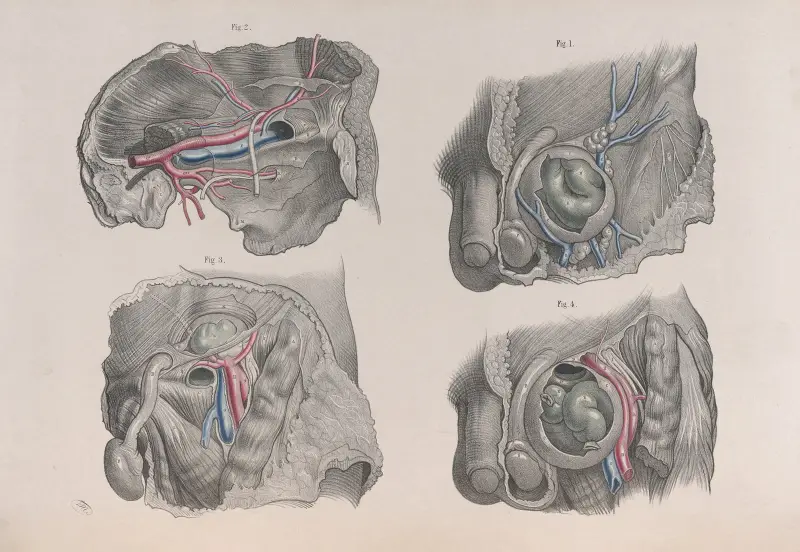Chirurgische Anatomie Taf. 37 von Joseph Maclise