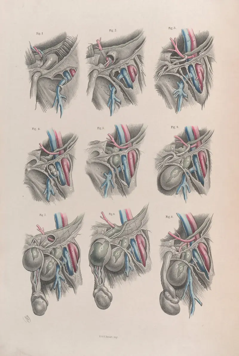 Surgical anatomy Pl.38 av Joseph Maclise