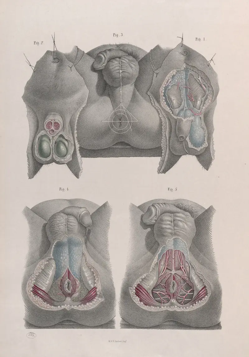Surgical anatomy Pl.42 av Joseph Maclise
