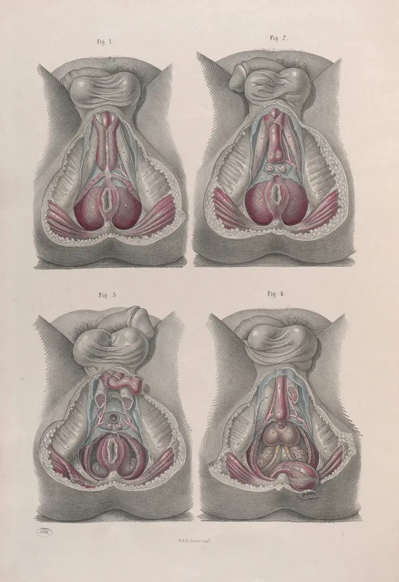 Surgical anatomy Pl.43 av Joseph Maclise