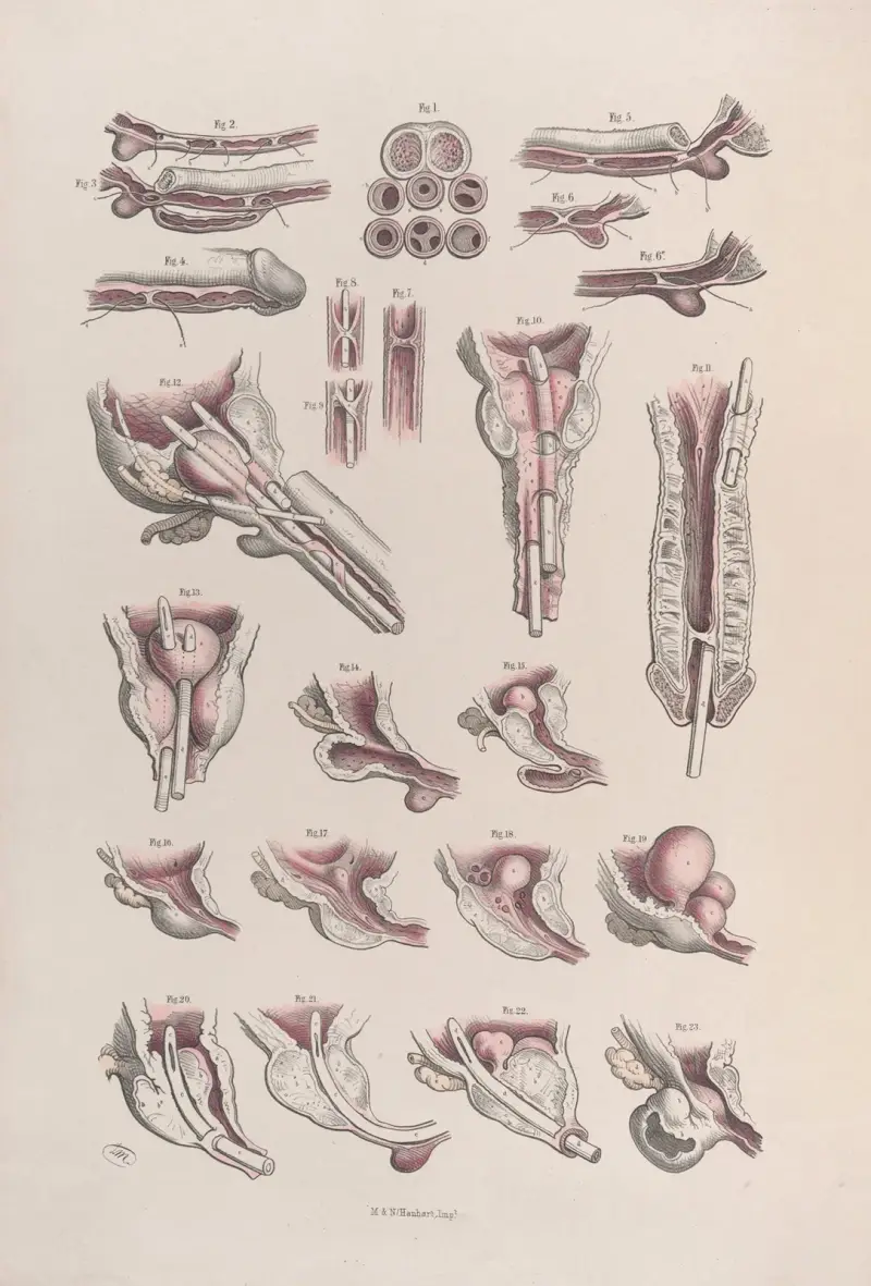 Surgical anatomy Pl.45 av Joseph Maclise