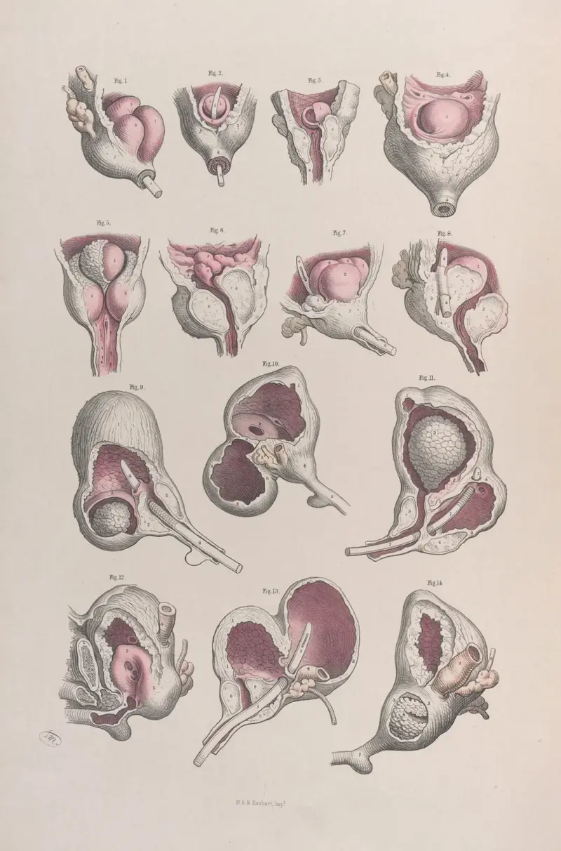 Surgical anatomy Pl.46 av Joseph Maclise