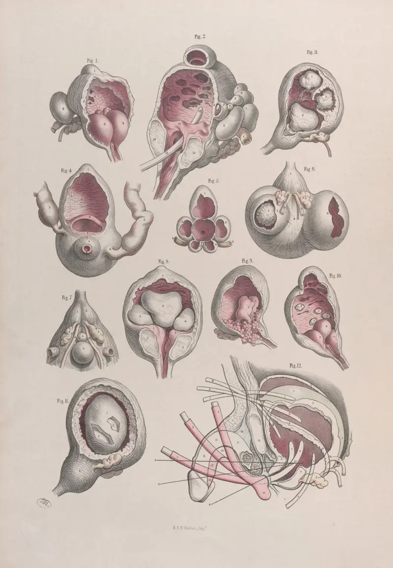 Surgical anatomy Pl.47 av Joseph Maclise