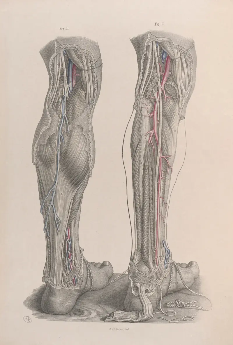 Surgical anatomy Pl.49 av Joseph Maclise