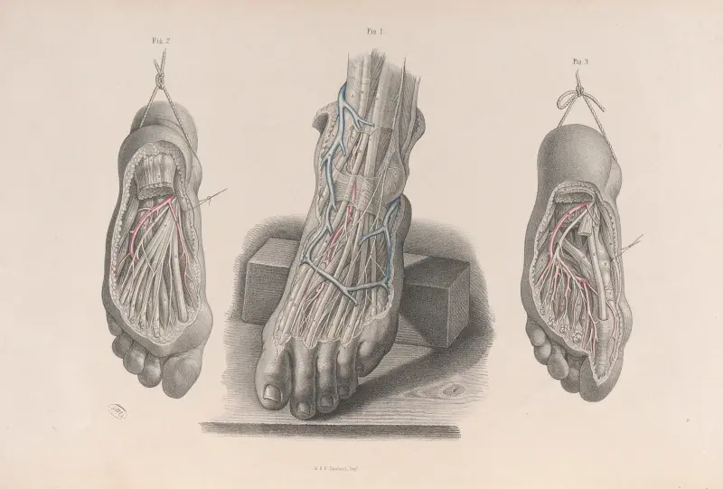 Surgical anatomy Pl.51 av Joseph Maclise