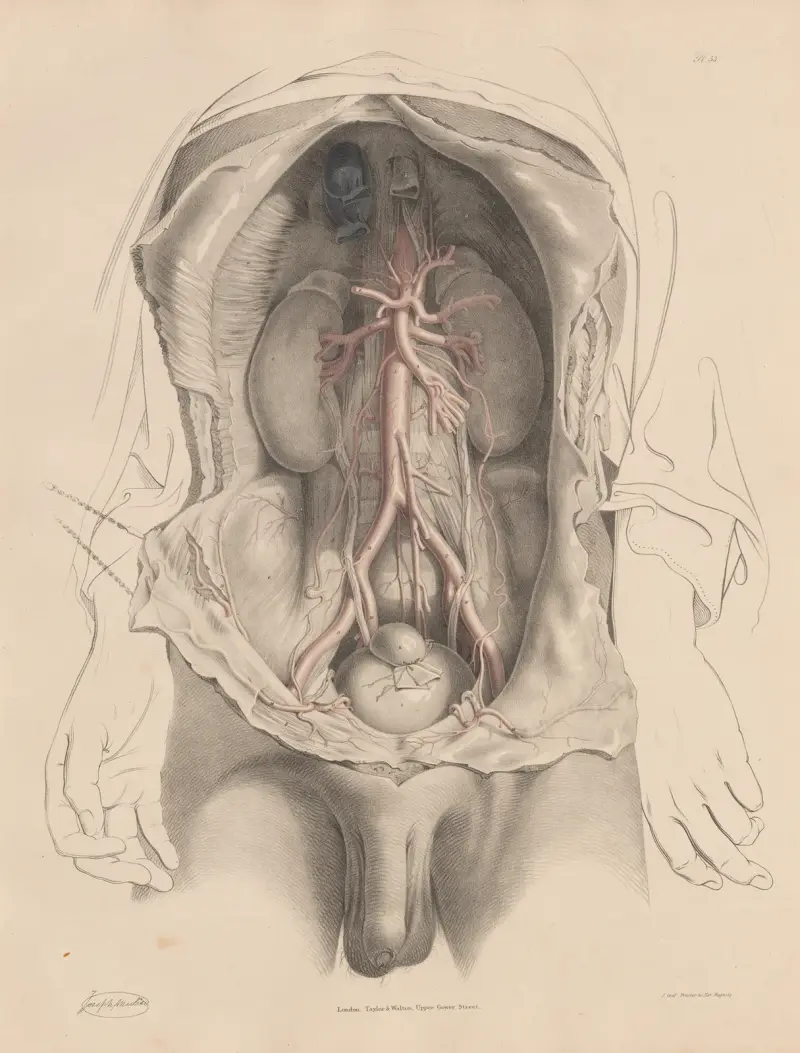 Bukaortan och de grenar som avgår under dess förlopp. Höftartärerna av Joseph Maclise