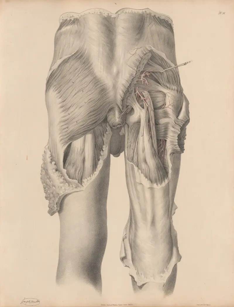 Die Arterien der hinteren Beckenfläche von Joseph Maclise
