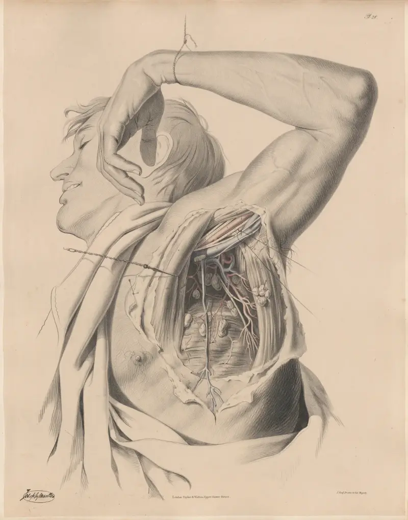 The Axilla, seen from below,—showing the Arteries, the Veins, the Nerves, and the Lymphatic glands av Joseph Maclise