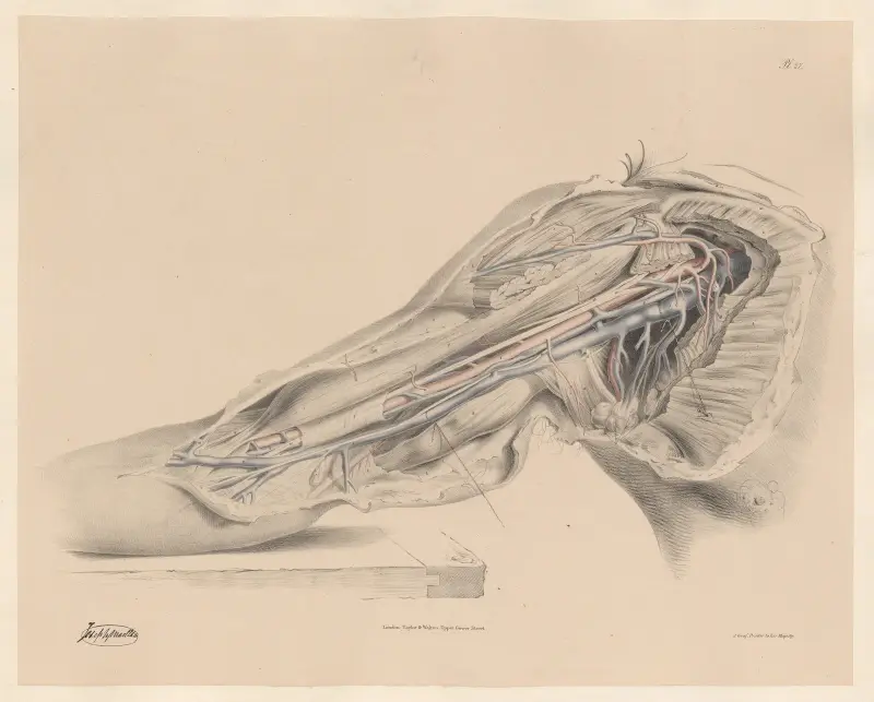 Armhålans och överarmens artärer, med tillhörande vener och nerver av Joseph Maclise