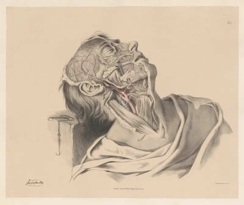 Den yttre halspulsådern och dess grenar av Joseph Maclise