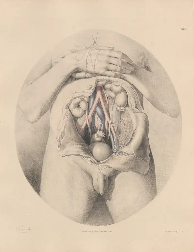 Die Iliakalarterien in Verbindung mit den Venen von Joseph Maclise