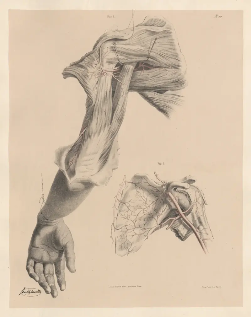 Den bakre och främre kringliggande artären samt artärerna på skulderbladets framsida av Joseph Maclise