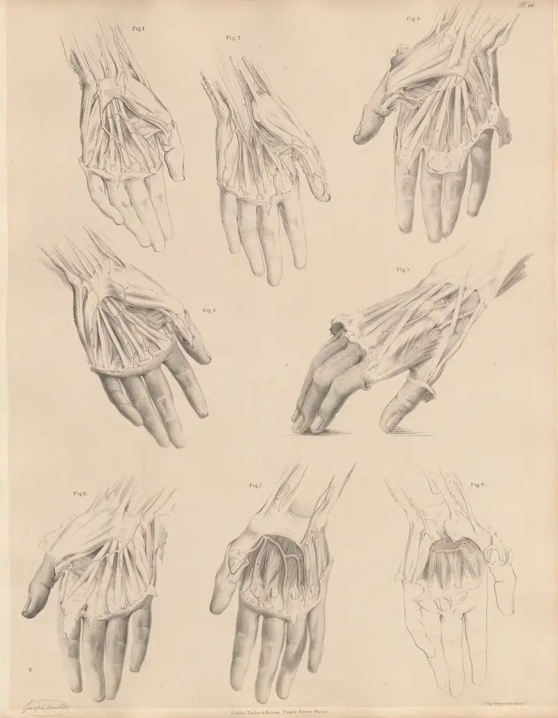 Various conditions of the arteries of the hand av Joseph Maclise