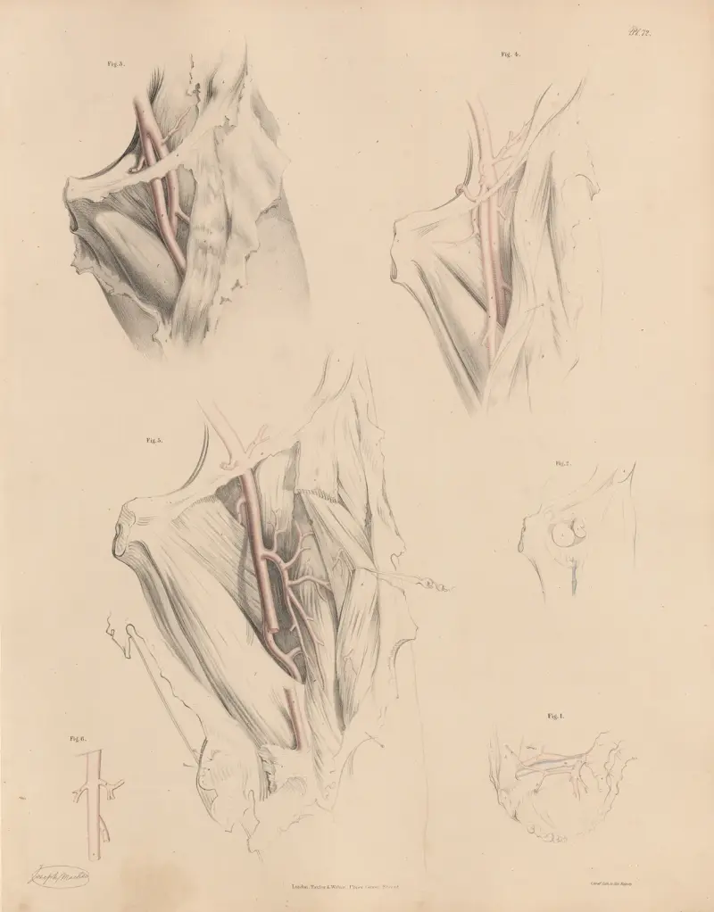 Various forms of the Deep Femoral artery av Joseph Maclise