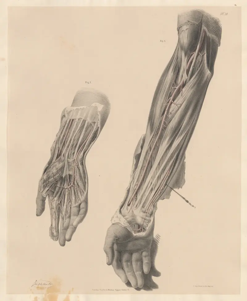 Ansichten der vorderen Arterien des Unterarms und der Hand – ihre übliche Anordnung von Joseph Maclise