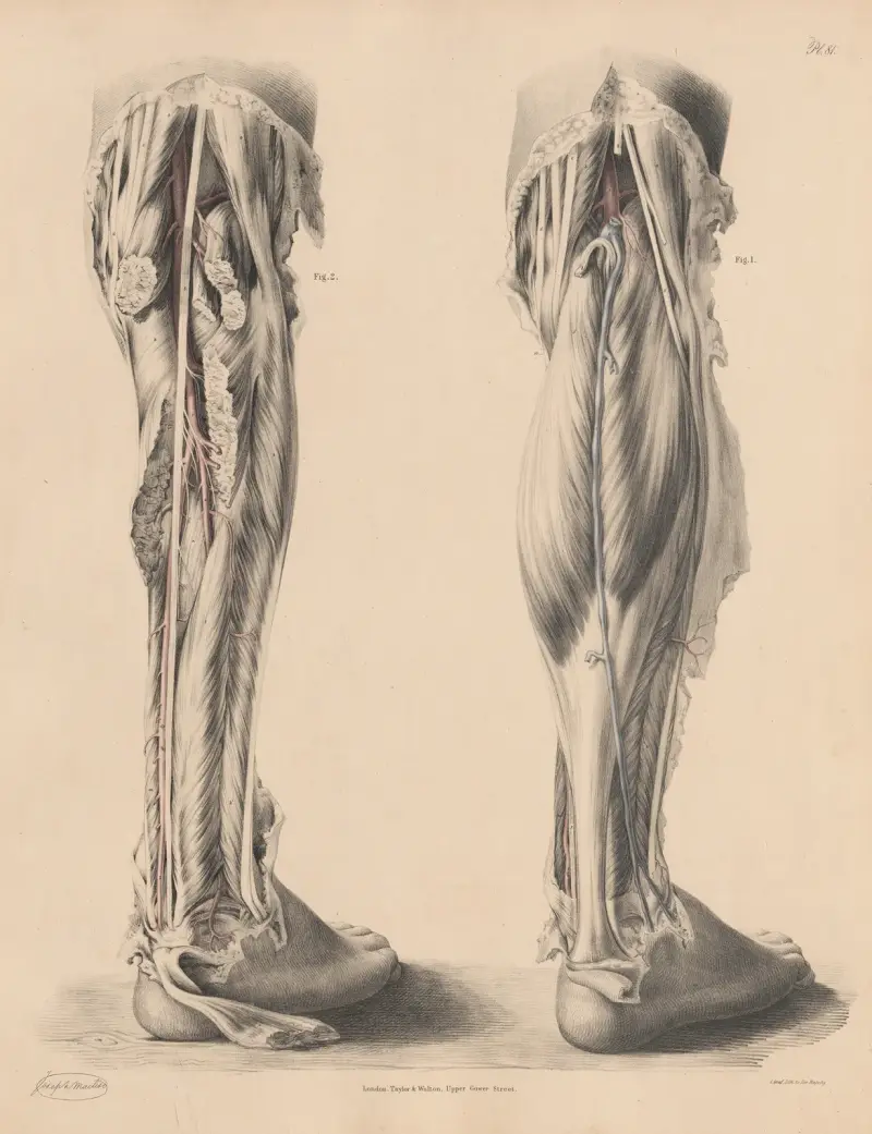 Pohled na tepny na zadní straně bérce – poplitea, tibialis posterior a fibularis, Joseph Maclise