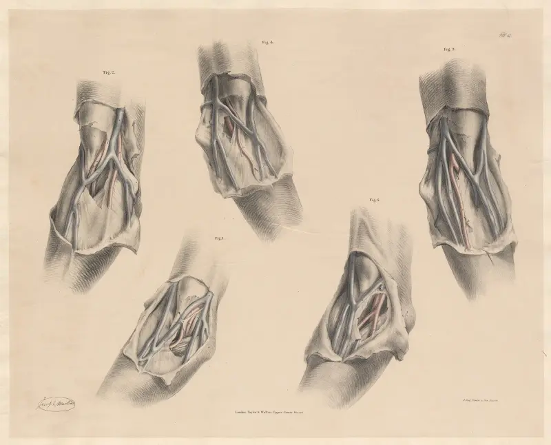 Vy av de ytliga venerna framför armbågsleden, i samband med flera variationer av artärerna av Joseph Maclise