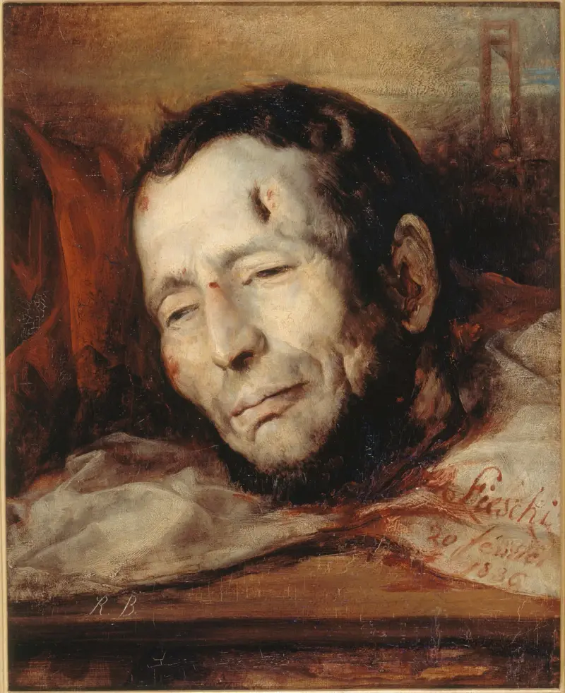 Huvud av Giuseppe Fieschi (1790–1836), efter hans avrättning av Jacques-Raymond Brascassat