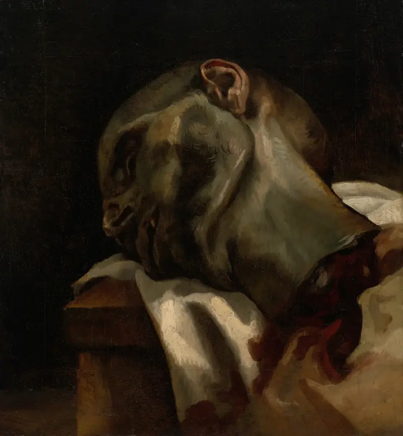 Huvud av en giljotinerad man av Théodore Géricault